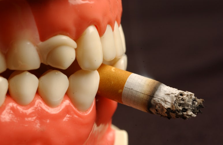 Jungang-dong Dental Implants: If You Smoke, Start Preparing in Advance image 2