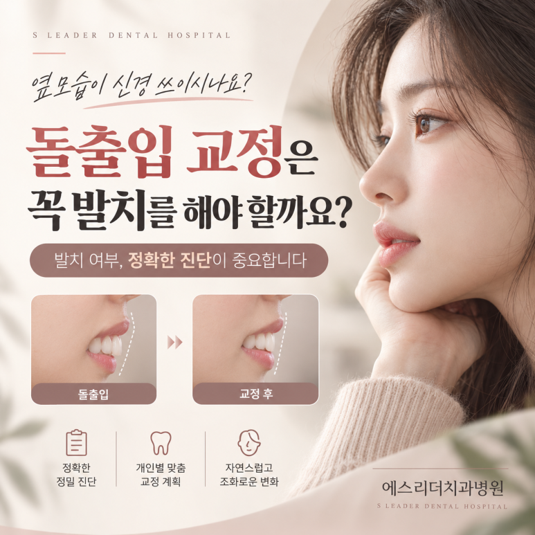 건대입구역치과, 돌출입 교정은 꼭 발치를 해야 할까요? 관련 이미지 1