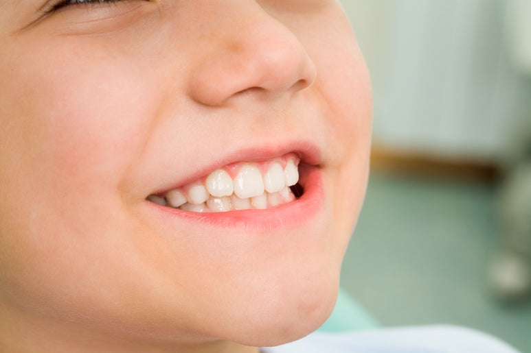 [Neungdong Dental Clinic] Orthodontics: Do You Have to Extract Teeth? Criteria for Deciding Whether Extraction Is Necessary image 4