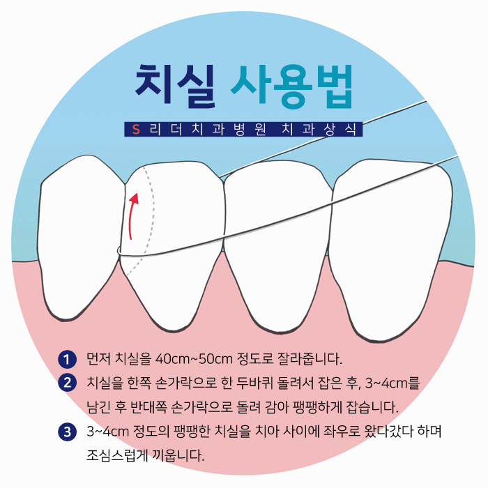 구의역치과추천 치실사용법 쉽게 알아보세요 관련 이미지 3