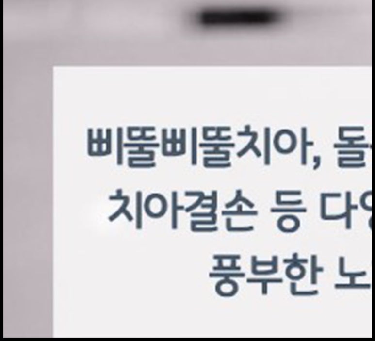 아차산역치과 교정치과 vs 안면윤곽술 치아교정에 대한 오해 관련 이미지 13