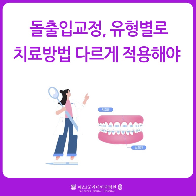 [사가정역치과] 돌출입 교정, 유형별로 치료방법 다르게 적용해야 관련 이미지 1