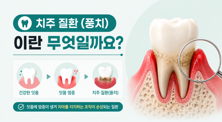 군자역치과, 풍치가 진행되면 나타나는 증상과 잇몸 치료방법 관련 이미지 3