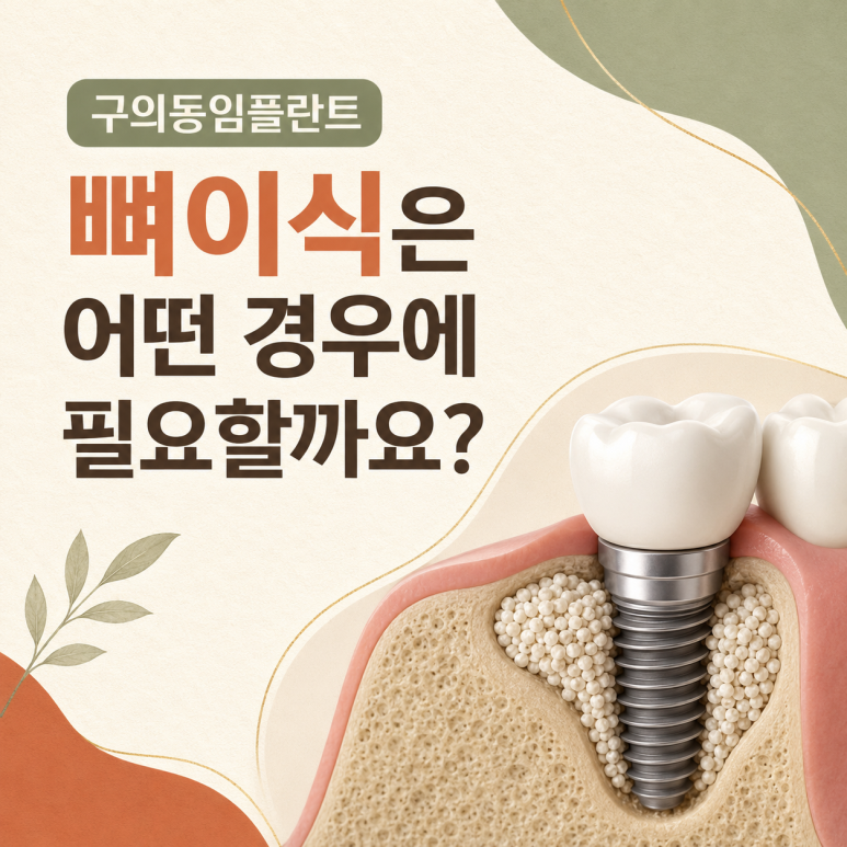 구의동임플란트 뼈이식은 어떤 경우에 필요할까요? 관련 이미지 1