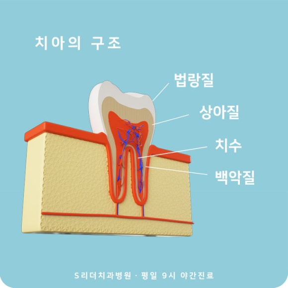 광진구치과 추천 충치치료 레진, 인레이, 크라운 어떤진료 해야할까 관련 이미지 1