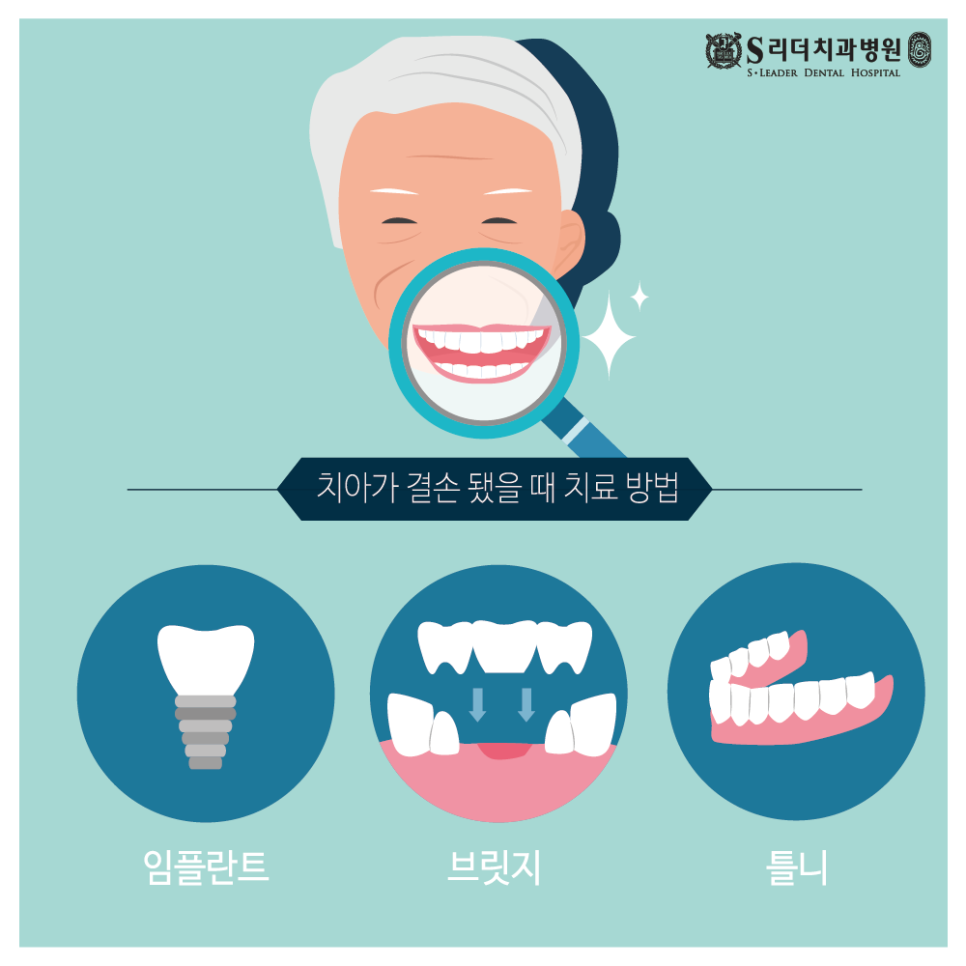 자양동치아미백 치과 누런이 관리하는 방법 관련 이미지 19