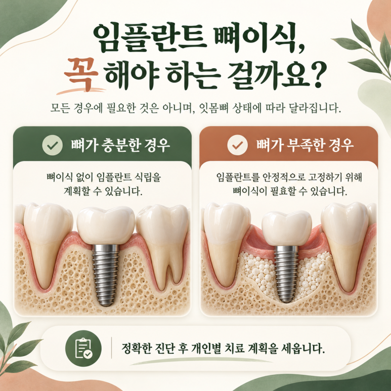 건대입구역치과 임플란트 뼈이식, 꼭 해야 하는 경우는? 관련 이미지 3