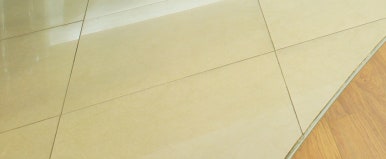 면목동치과 소아청소년 스케일링, 치주질환유병률에 대해 관련 이미지 21