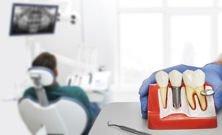 How Long Is the Recovery Period After Bone Grafting for Implants at Konkuk Univ. Station? image 2