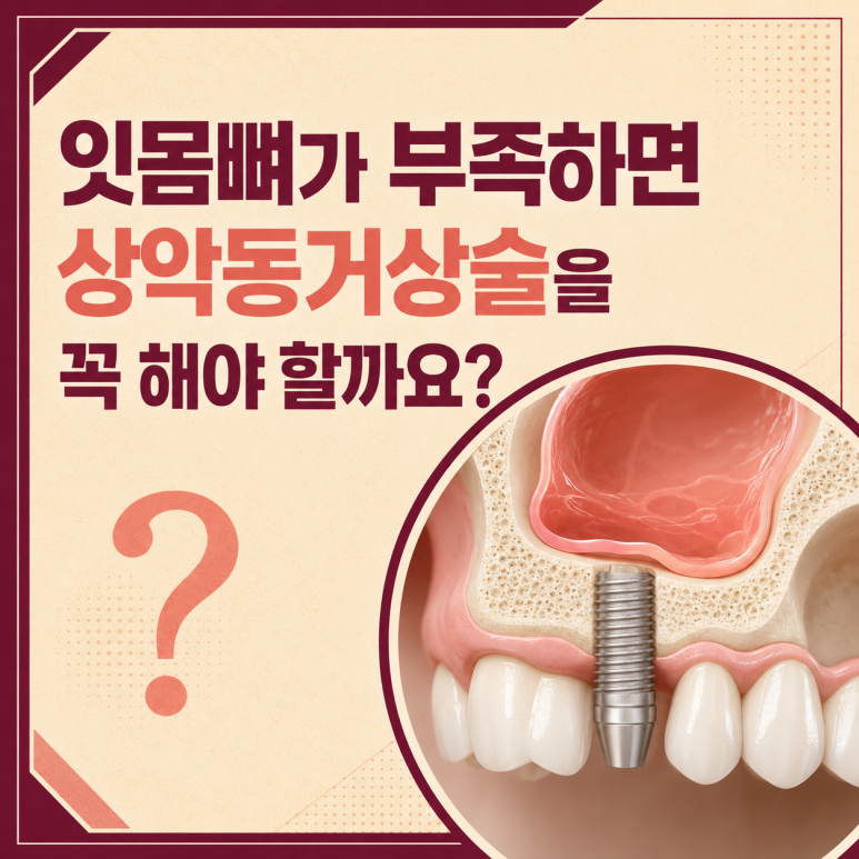 송정동치과 잇몸뼈가 부족하면 상악동거상술을 꼭 해야 할까요? 관련 이미지 1