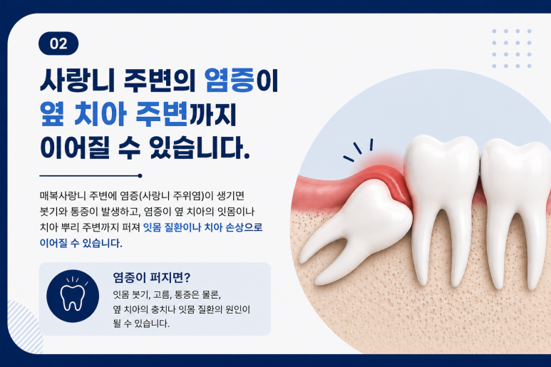 건대입구치과, 매복 사랑니가 옆 치아에 영향을 줄 수도 있을까요? 관련 이미지 5