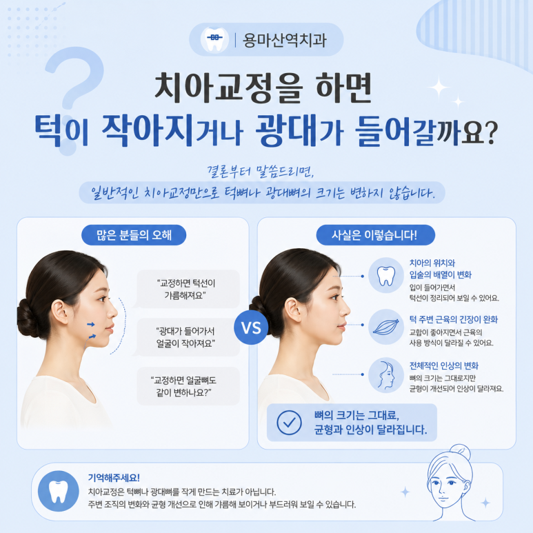 용마산역치과, 치아교정 후 얼굴형은 정말 달라질까요? 관련 이미지 6