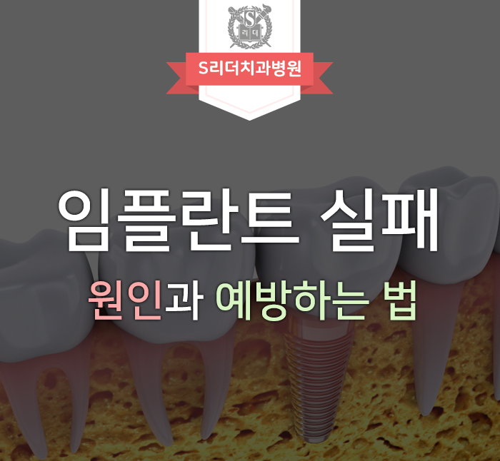 임플란트실패의 원인과 실패를 예방하는 방법은? 관련 이미지 1