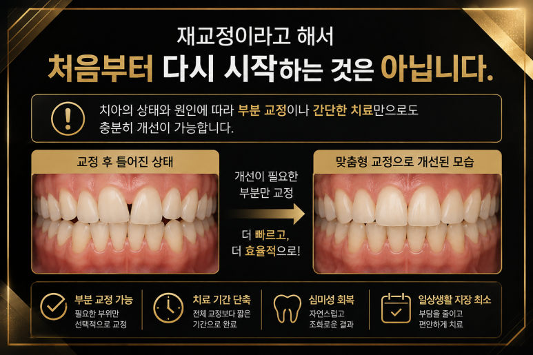 광장동치과 교정 후 다시 틀어지는 이유와 재교정이 필요한 경우 관련 이미지 8