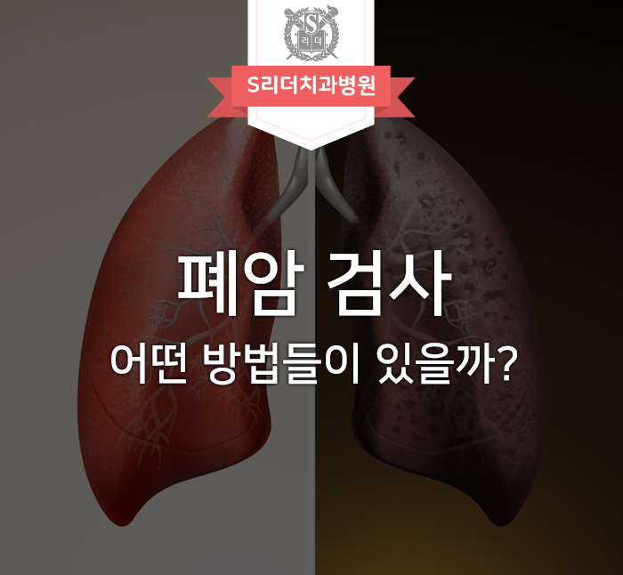 폐암 검사하는 방법, 어떤 검사들이 있을까요? 관련 이미지 1