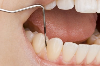 Junggok Station Dental Clinic | Why Does It Feel Like My Gums Have Gone Down During Orthodontic Treatment? Is That Normal? image 6