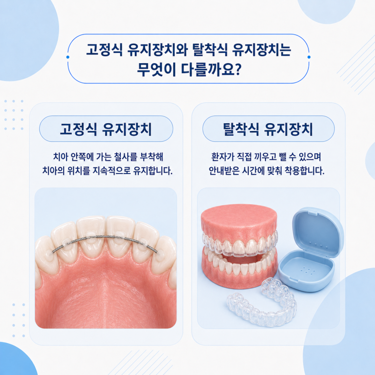 건대치아교정, 교정 후 유지장치는 평생 착용해야 할까요? 관련 이미지 5