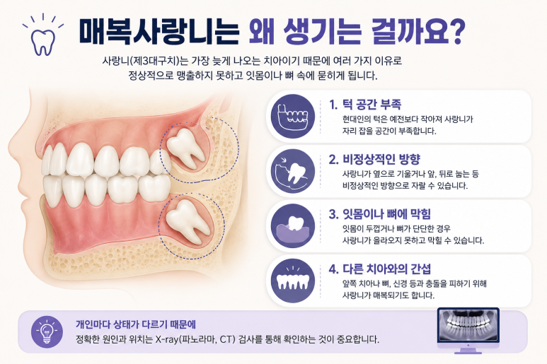 구의동치과 매복 사랑니를 오래 방치하면 어떤 문제가 생길까요? 관련 이미지 2