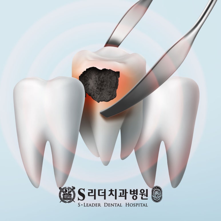 구의동치과 건강행태조사 칫솔질의 중요성 알아봐요. 관련 이미지 3