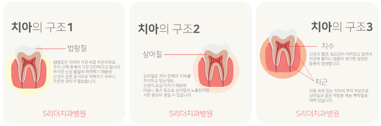 자양동치과 잇몸퇴축으로 치아시림 있다면 관련 이미지 16