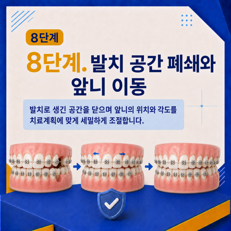 군자역치과 치아교정은 어떤 순서로 진행될까요? 단계별 과정 정리 관련 이미지 9