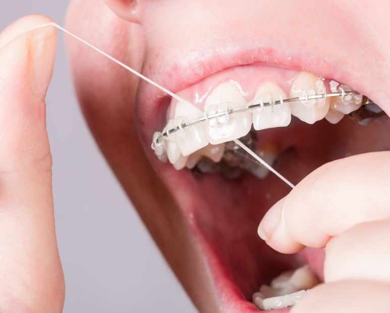 Ttukseom Station Dental Clinic: Is Orthodontic Treatment in Your 30s & 40s Too Late? 5 Things to Know Before Starting Adult Orthodontic Treatment image 8