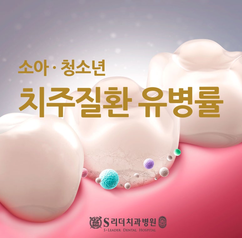 면목동치과 소아청소년 스케일링, 치주질환유병률에 대해 관련 이미지 1
