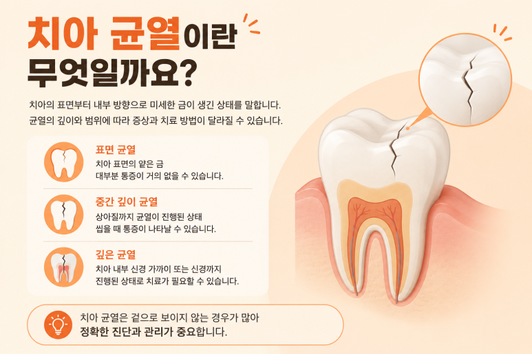 송정동치과, 씹을 때만 치아가 찌릿하다면 치아 균열 때문일까요? 관련 이미지 2