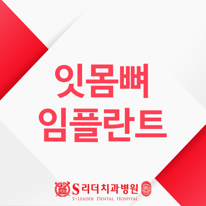 잇몸뼈임플란트 왜? 어떻게? 궁금증 해결 관련 이미지 1