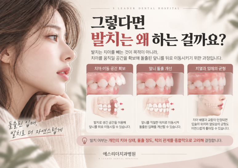 건대입구역치과, 돌출입 교정은 꼭 발치를 해야 할까요? 관련 이미지 3