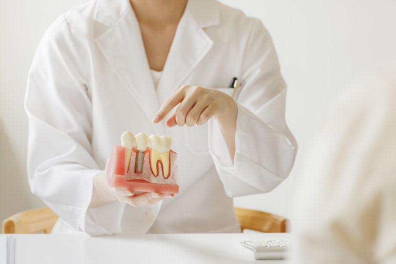 [Gwangjin-gu Implant] Important Things to Check Before Getting a Molar Implant and Its Cost image 4