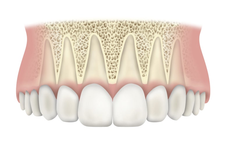Worried About Front Tooth Implants in Your 20s? Solve It at Jayang-dong Dental Clinic image 2