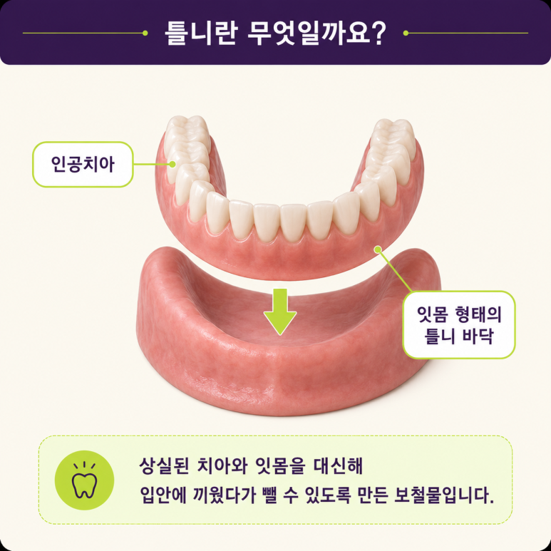 성수동임플란트, 치아 상실 후 임플란트·브릿지·틀니 어떤 차이가 있을까? 관련 이미지 7