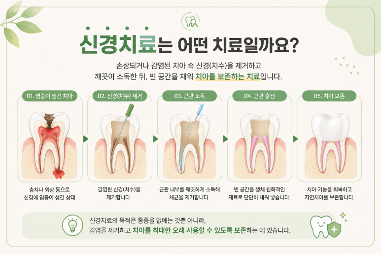 자양동치과, 신경치료를 했는데 왜 크라운까지 해야 할까요? 관련 이미지 2
