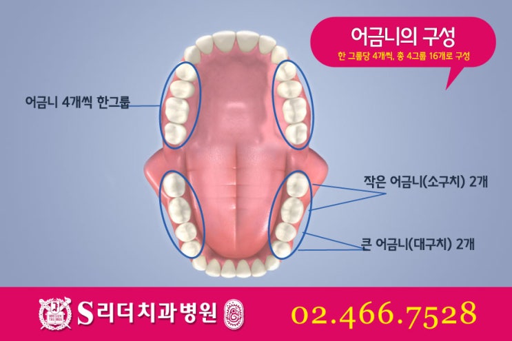 어금니임플란트 알면 좋은정보! 관련 이미지 3