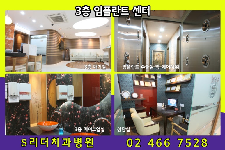 건대임플란트 치료양은 적게 하면서 효과는 높게 도출... 관련 이미지 6