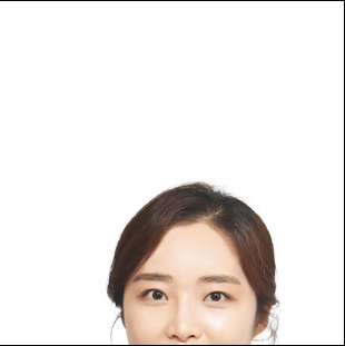 성동구치과 보철물탈락원인 대처법 에스리더치과병원에서! 관련 이미지 15