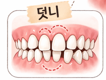 Konkuk University Entrance Station Dentist | Malocclusion: From Diagnosis to Orthodontic Planning, Explained Step by Step image 2
