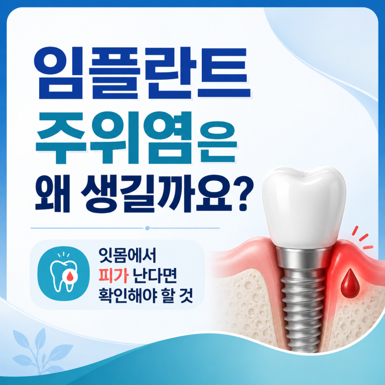 광진구치과 임플란트 주위염은 왜 생길까요? 잇몸에서 피가 난다면 확인해야 할 것 관련 이미지 1