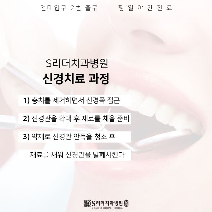 광진구신경치료 왜 오래걸리나요?에 대한 답변 관련 이미지 3