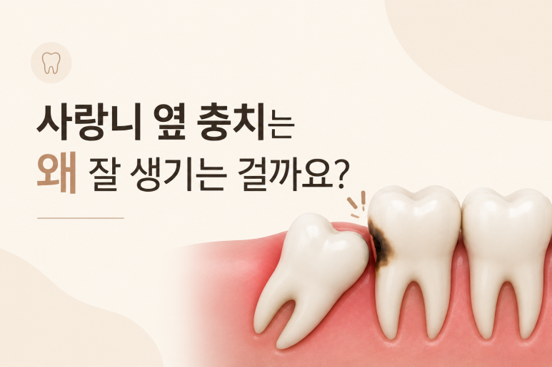 구의동치과｜사랑니 옆 충치가 생기는 이유와 관리 방법 관련 이미지 2