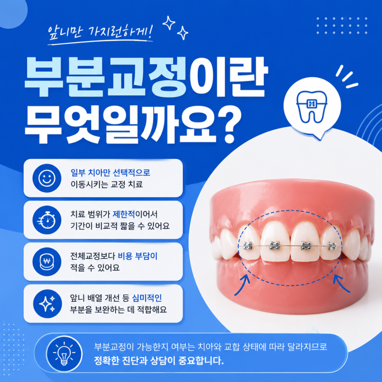 답십리동치과, 부분교정과 전체교정의 차이는? 나에게 맞는 교정 방법은 무엇일까요? 관련 이미지 2