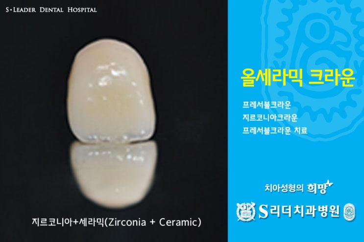 건대치과 치아성형 잘하는 곳 궁금해? 관련 이미지 6
