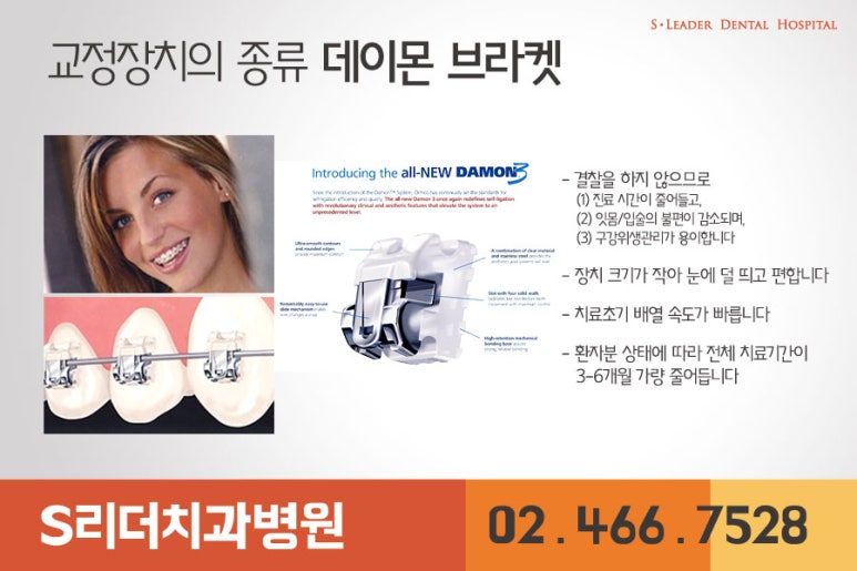 광진구교정치과 교정할때의 통증... 관련 이미지 5