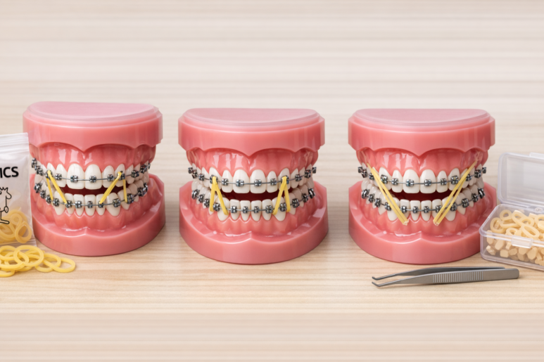 Gwangjin-gu Dental Clinic Recommendation: How Important Is the Elastic Stage in Orthodontic Treatment for Improving Protruding Mouths? image 4