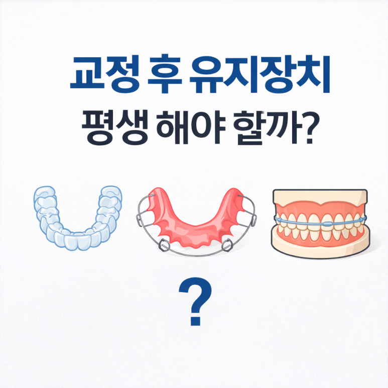 Junggok-dong Dental Clinic: Do You Have to Wear a Retainer for Life After Orthodontic Treatment? A Complete Guide to Retainer Duration image 1