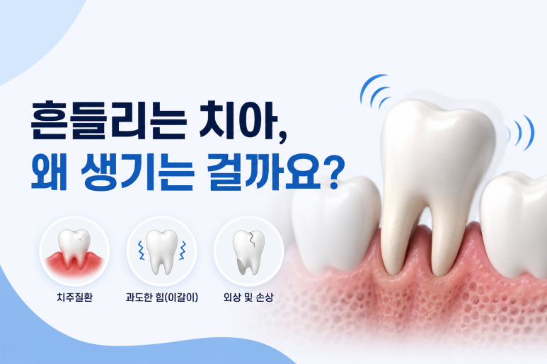 건대입구임플란트|“아직 안 아픈데”.... 흔들리는 치아 방치하면 늦는 이유 관련 이미지 2