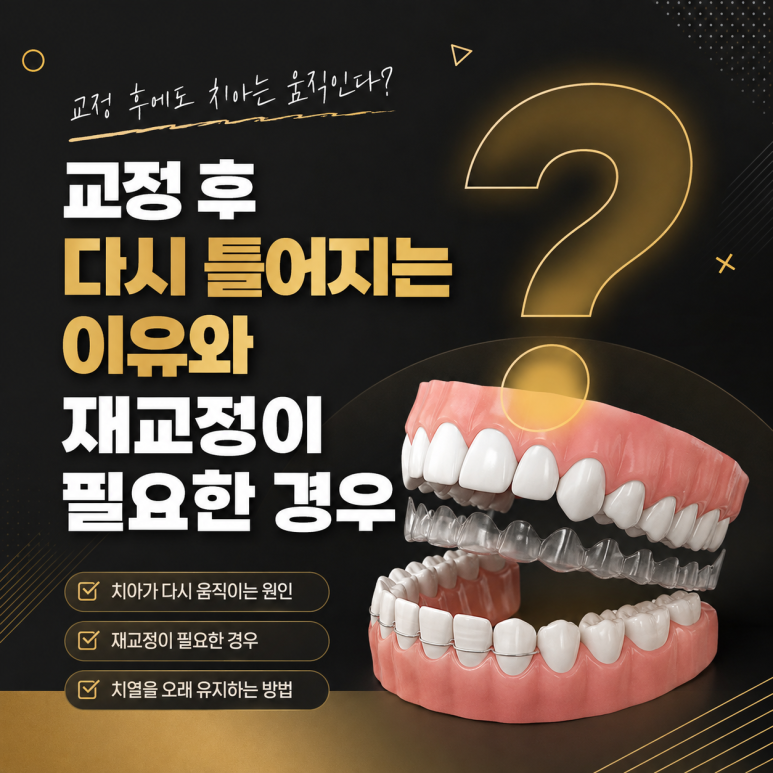 광장동치과 교정 후 다시 틀어지는 이유와 재교정이 필요한 경우 관련 이미지 1