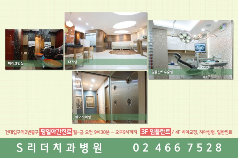 어금니임플란트 왜자꾸반복될까? 관련 이미지 4