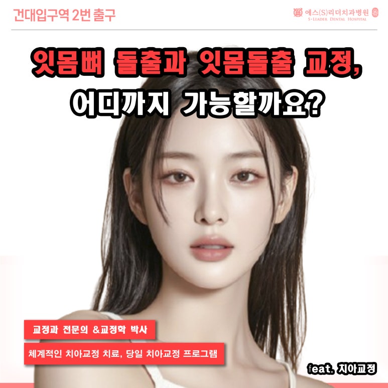 [Seongdong-gu Dental Clinic] How Far Can Gum Bone Protrusion and Gum Protrusion Correction Go? image 1